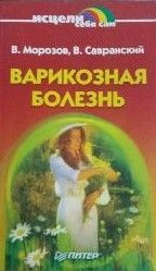 Варикозная болезнь