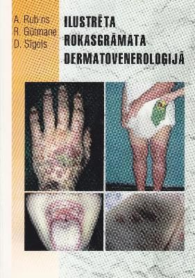 Ilustrēta rokasgrāmata dermatoveneroloģijā