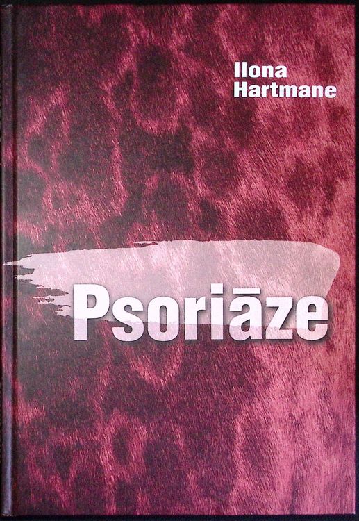 Psoriāze
