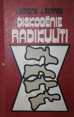 Diskogēnie radikulīti